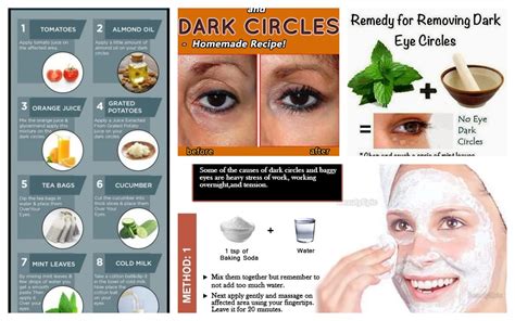 dark circles under eyes treatment.